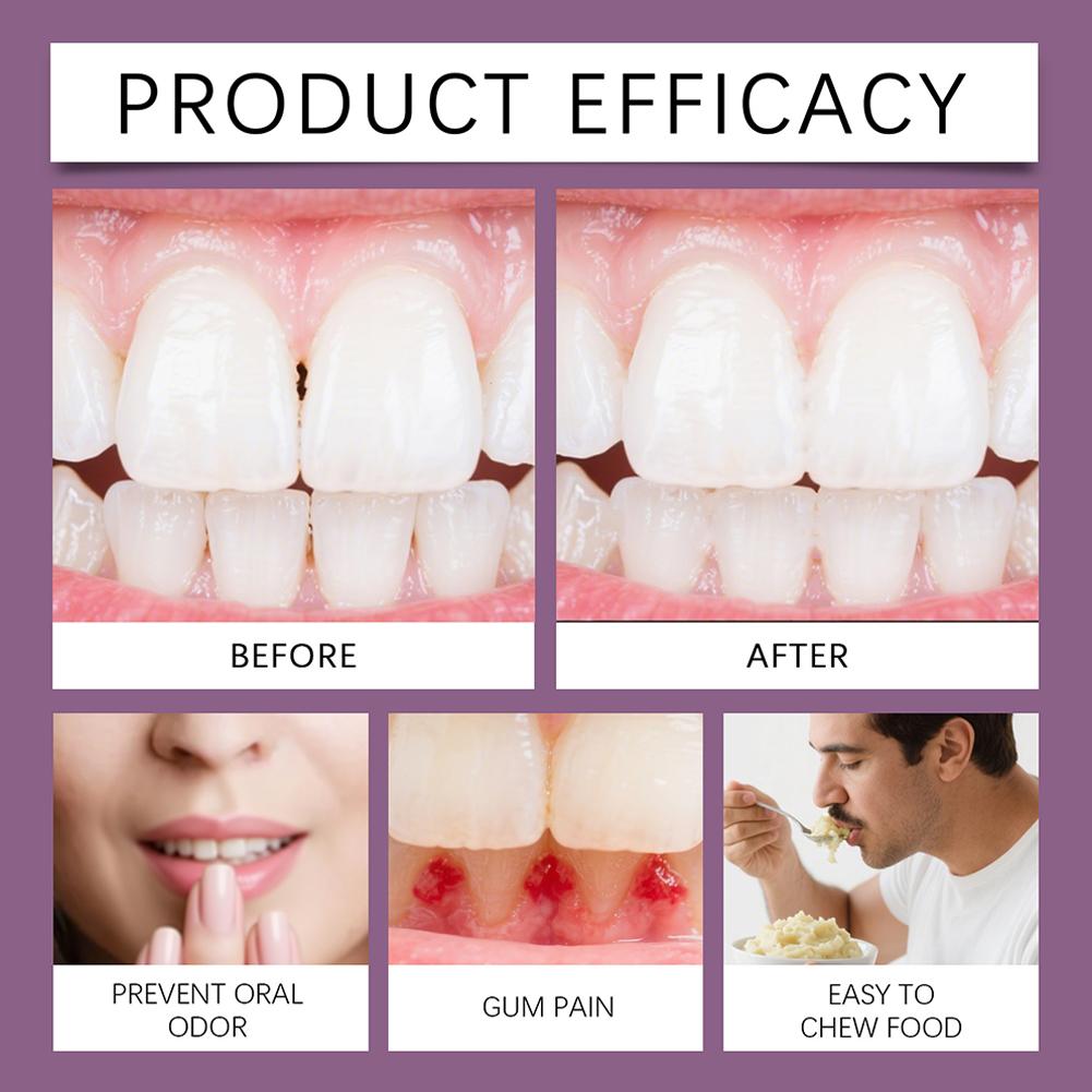 40g Denture Fixing Adhesive Cream Strong Complete Professional Dentures Glue Strong Adhesion Comfortable Temporary Denture Care