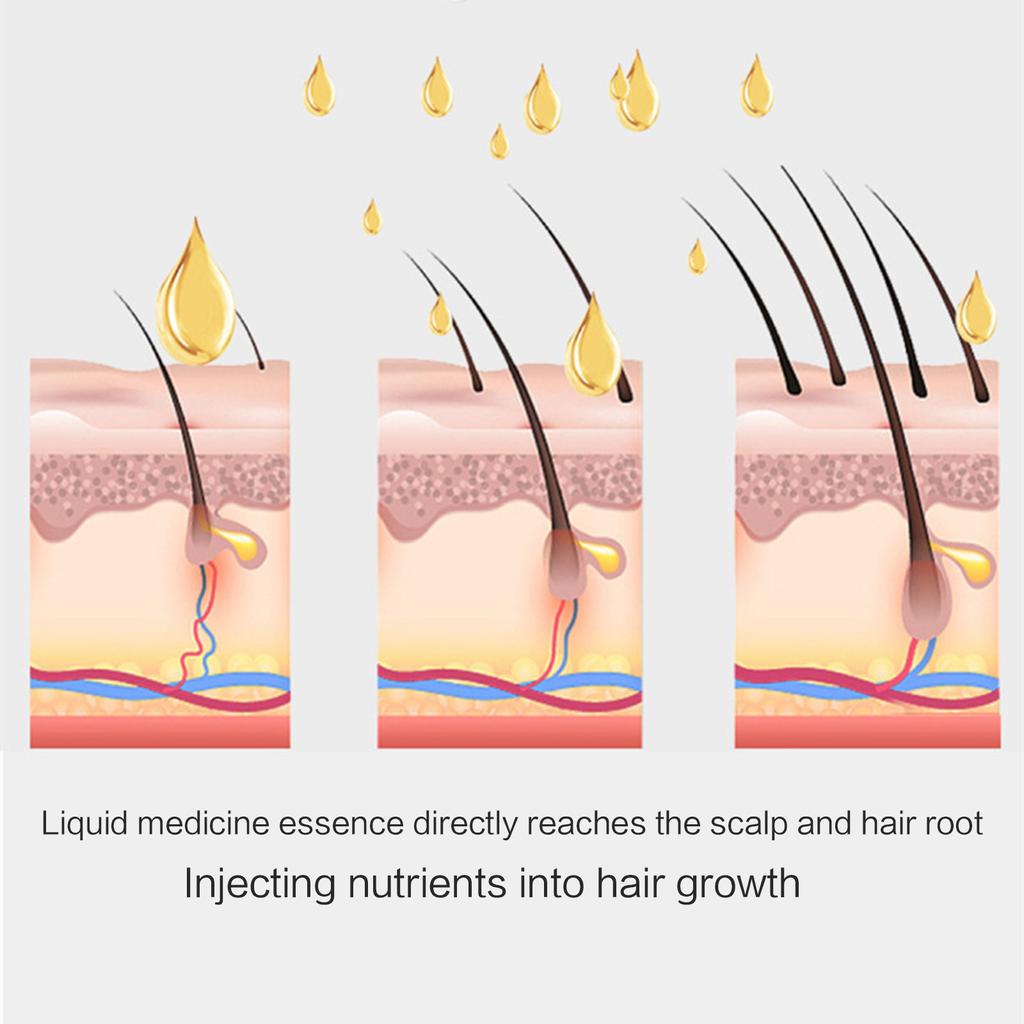 Scalp Massager Hair Oil Applicator Hair Massager Scalp Applicator Brush for Hair Growth Medicine Essential Oil Serum