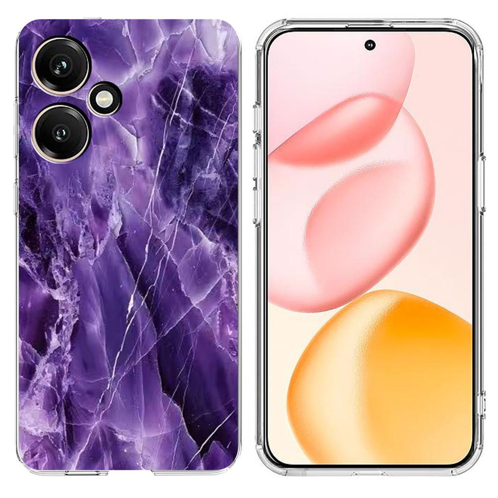 For Honor 400 5G (Global) Case Marble Pattern Printing Soft TPU Phone Cover