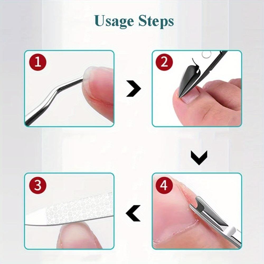 1PC Coupe-ongles Ongle incarné Podologie Correction Pince Coupe-cuticules Coupe Paronychie Pédicure Manucure Outil de Soin Mains Pieds