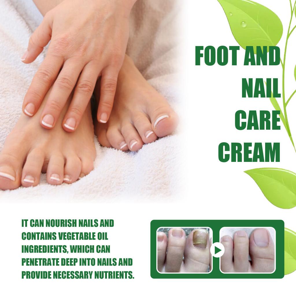 Ouhoe Nourishing Foot And Nail Care Cream For Soft Moisturized Healthy Feet