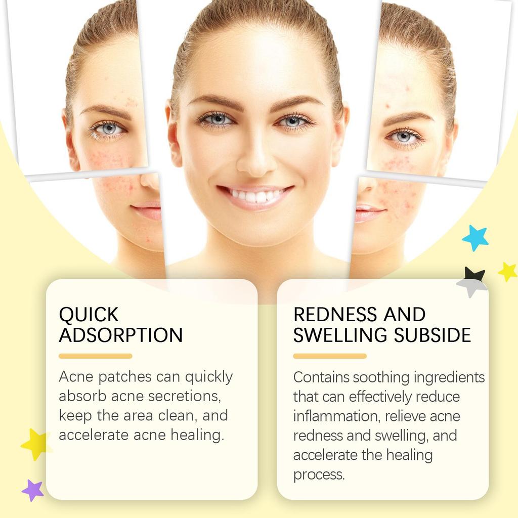 WIIEEY Star Pimple Patch Fade Down Pimple Pimple Marks Clean Face Closed Acne Portable Cartoon Pimple Patch