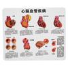 2X Life Size Heart Model Human Heart Teaching Model Simulation Heart Organ Model
