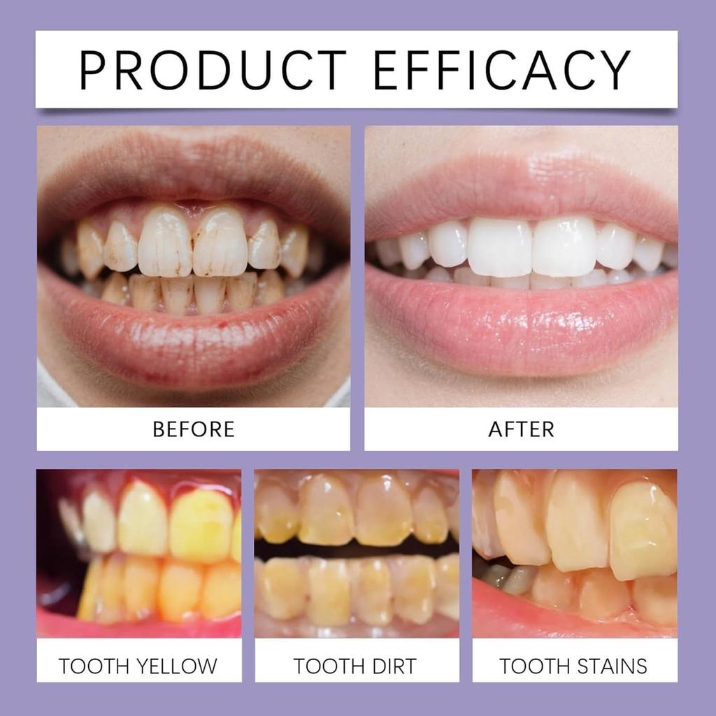 Bee Venom Dental Treatment Toothpaste, Natural Teeth Whitening Toothpaste, Fresh Breath, Natural Ingredients for Men and Women