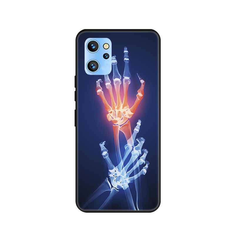 Etui do telefonu Umidigi A13 Pro 2022 Kwiaty Czarny Silikonowy Tylny Pokrowiec Miękki Pokrowiec TPU Do Umidigi A13S Etui A 13 S Coque Funda Torba