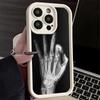 Phone Case for iPhone 17 Air 16E 15 16 Pro Max Funny X-Ray Hand Bones Cover 14 Plus 13 12 Mini Soft Shell Silicone Fundas