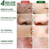 Salicylic Acid Pore Clearing Cream Shrink Pores Remove Blackheads Acne Brighten Moisturizing Smooth Skin Care Korean Products