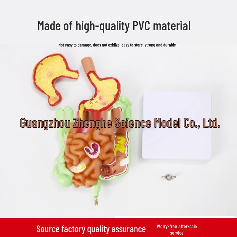 Human Digestive System Model: Stomach, Large Intestine, Cecum, Rectum, Duodenum.
