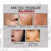 3 Pcs Collagen Boost Anti-Ageing Serum, 30ml Anti-Ageing Serum, Anti-Wrinkle Serum, Collagen Booster for Face
