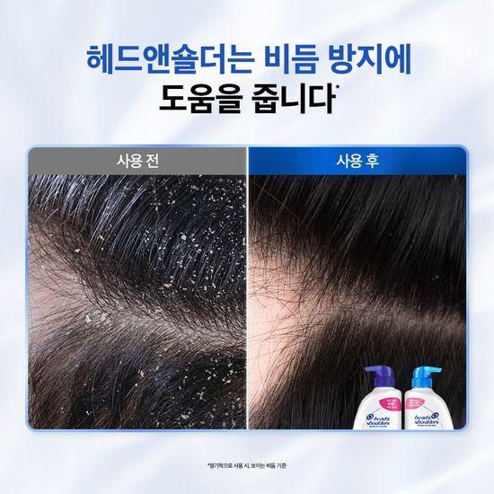 Head and Shoulders Garyo Cool Menthol Scalp Care Shampoo 520ml 2-pack Promotion, Choose 1