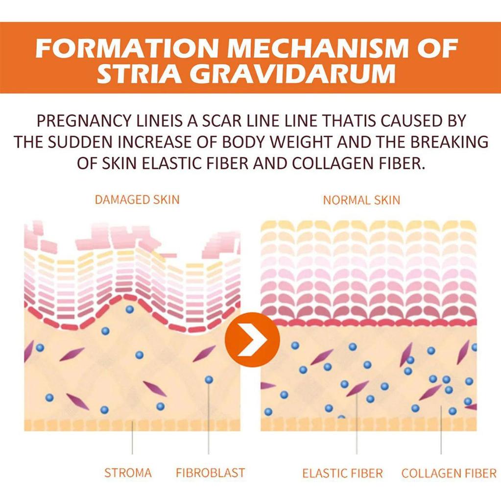 Masážní olej proti celulitidě – zpevňuje, zpevňuje pokožku – strie