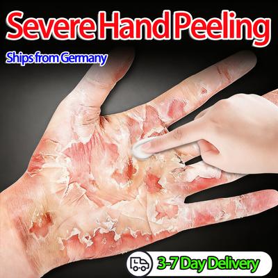 Soothing Moisturizing Anti-hair Loss Cream Gentle Penetration Relieves Dryness and Peeling