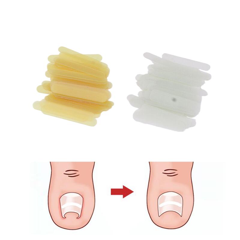 50Pcs/Box Pedicure Foot Toe Nail Ingrown Toenail Correction Tool Nail Treatment Elastic Sticker Straightening Foot Care Tools