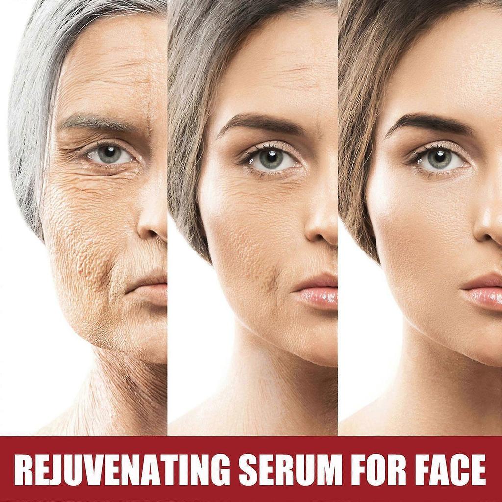 Limited time!!Hoygi Retinol Facial Serum Reduces Fine Lines, Wrinkles, And Nasolabial Folds, Moisturizes Facial Skin, Anti-Wrinkle Essence