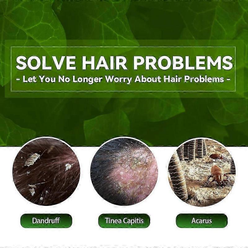 100ml Scalp Ringworm Anti-itch Shampoo Dandruff Control Oil Anti-itch Shampoo Anti-loss Oil Control Refreshing Shampoo