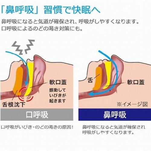 Anti-snoring, Nose Breathing, Mouth Breathing, Soft Chin Support, Double Chin, Facial Sagging, Travel, Slimming, Correction Belt