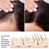 1-3x 50ml Ouhoe Hair Growth Spray Moisturizes Scalp Hair Damaged Strong Hair Dense Hair Growth Spray