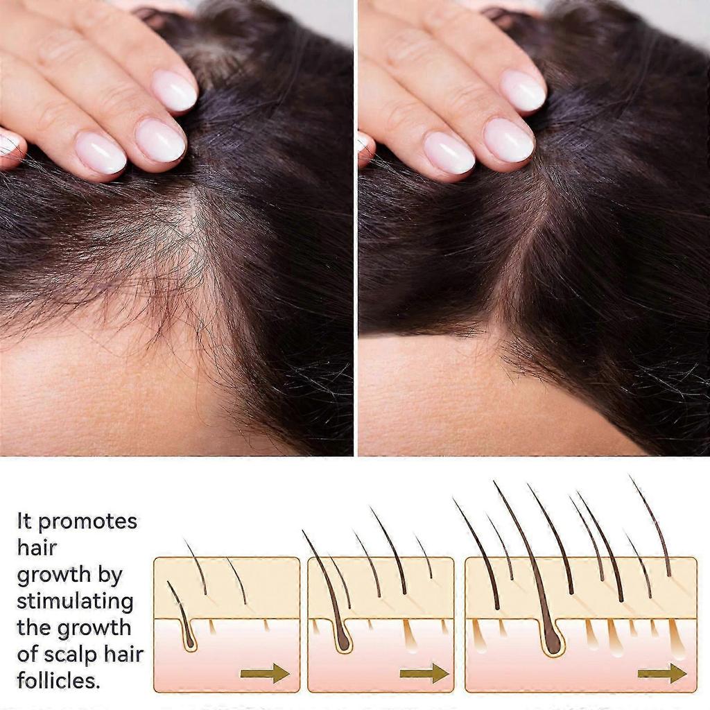 1-3x 50ml Ouhoe Hair Growth Spray Moisturizes Scalp Hair Damaged Strong Hair Dense Hair Growth Spray