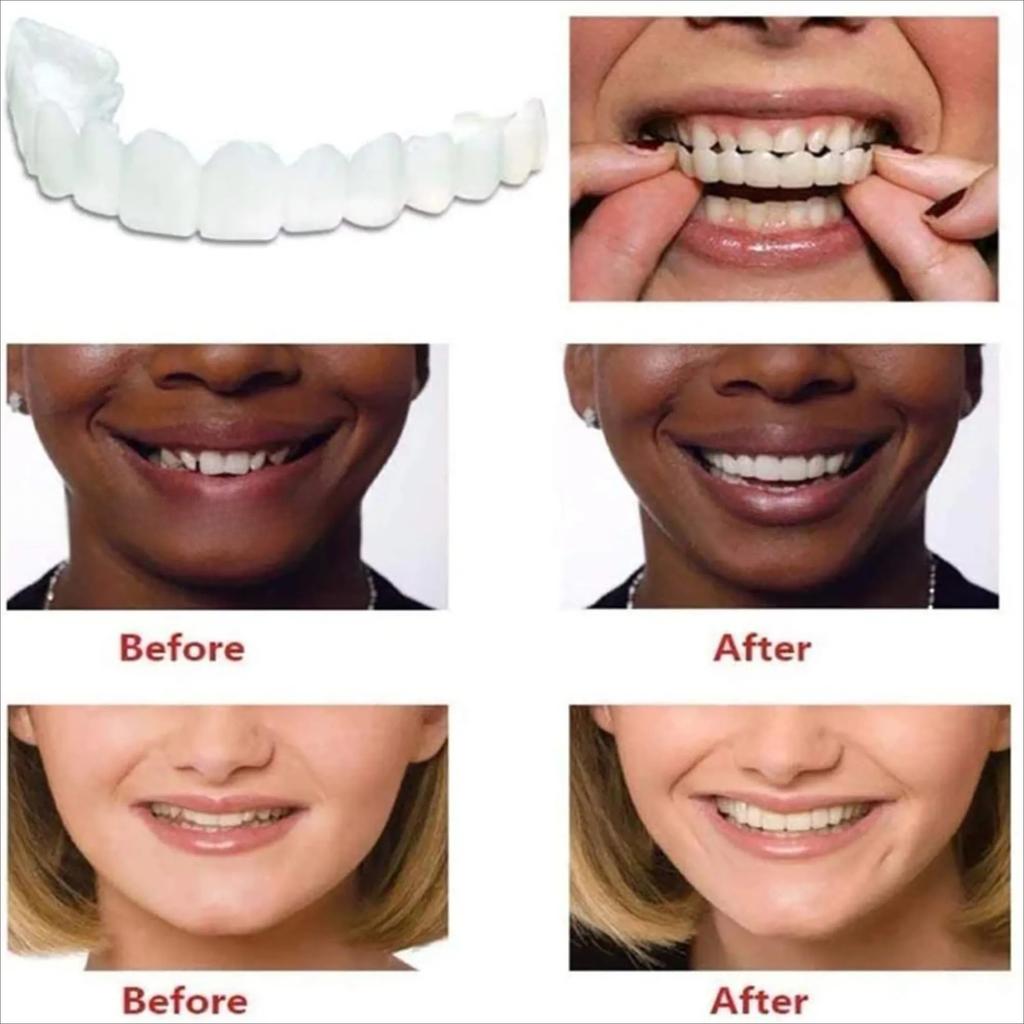 Upper Teethlower Teeth Silicone Teeth Whitening Teethcover Teeth Braces Simulation Denture With Box Perfect Smile New
