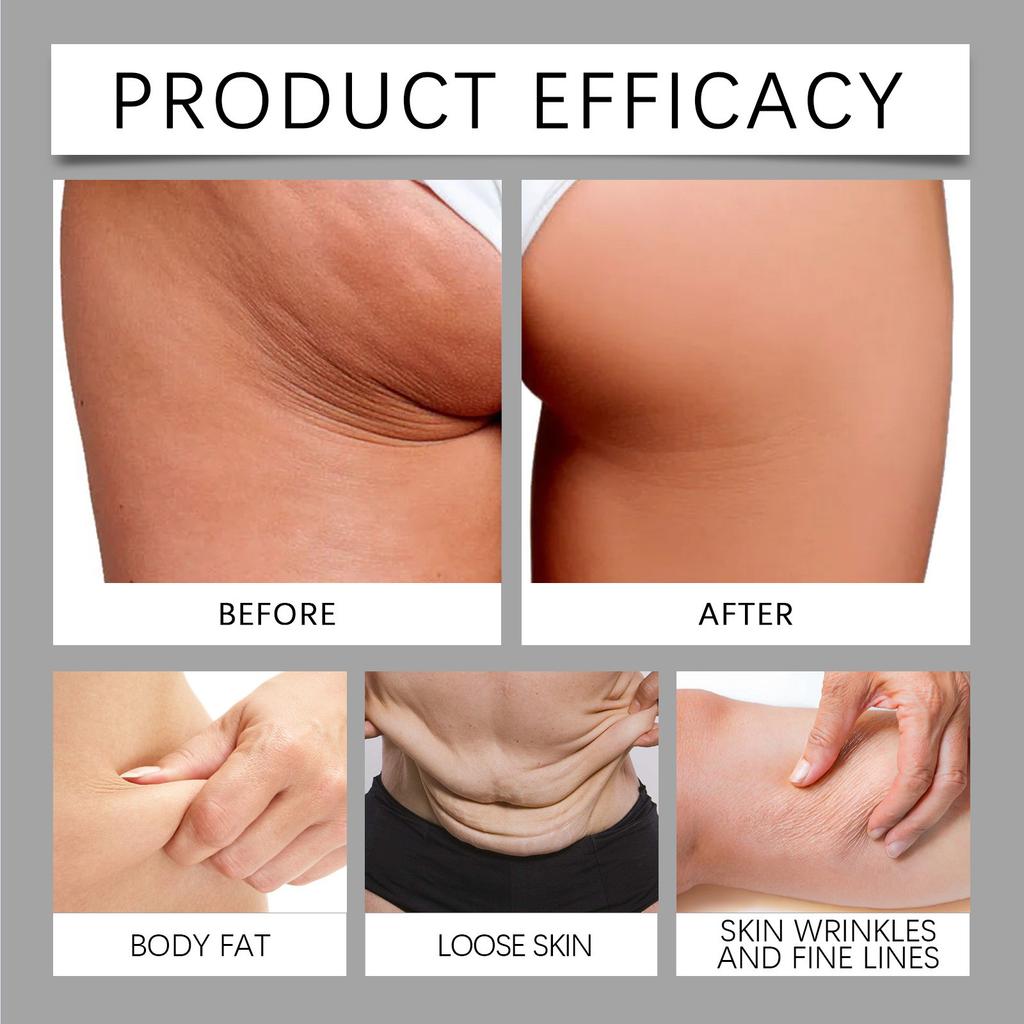 Anti-Aging Retinol Gesichtsfeuchtigkeitscreme mit Hyaluron, Tag- und Nachtgesichtscreme für Frauen und Männer