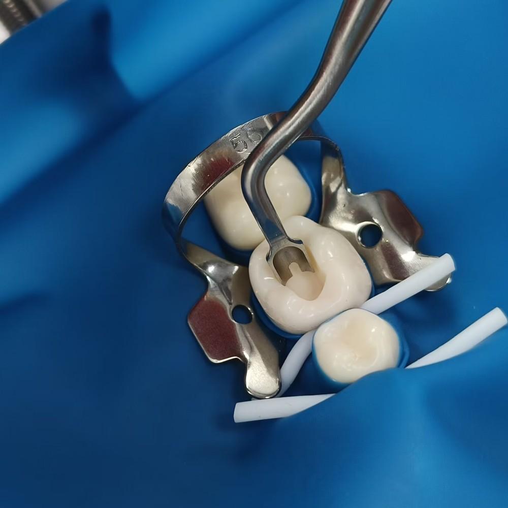 Dental Contact Former TightContact Tool for Achieving Tight and Large Proximal Contacts Dental Composite Filling Instrument