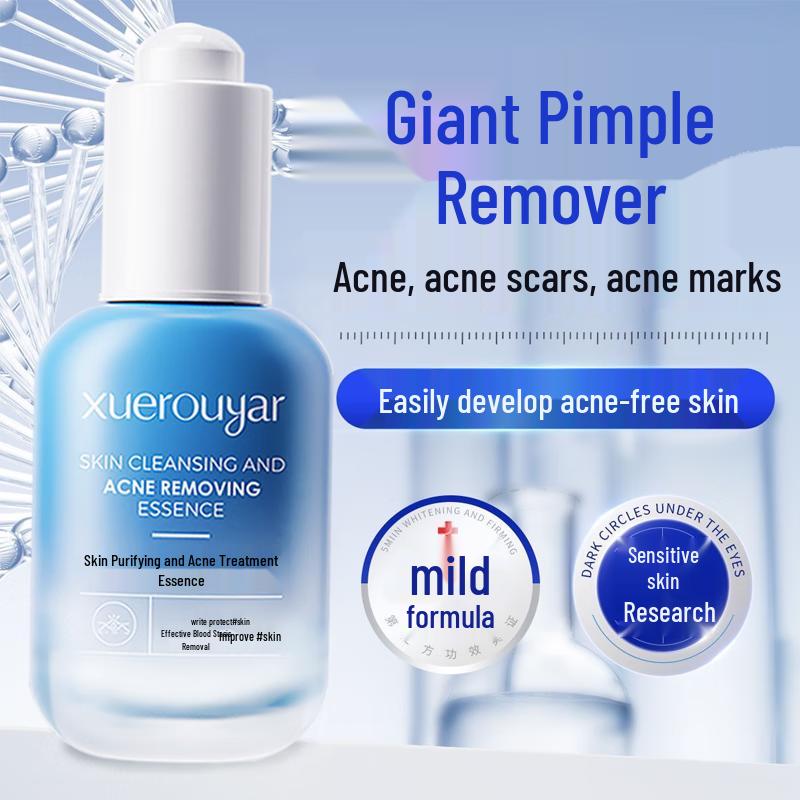 BEAUTY NOTES Teen Skincare for Acne & Blemishes