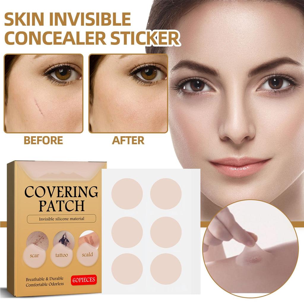 Skin Concealer Patch, Skin Scar Acne Mark Cover Patch Skin Color Patch Waterproof