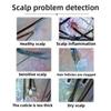Household High Definition Scalp Detector Inspection Instrument Intelligent Analysis Hair Follicle Hair Detector Analysis Instrument