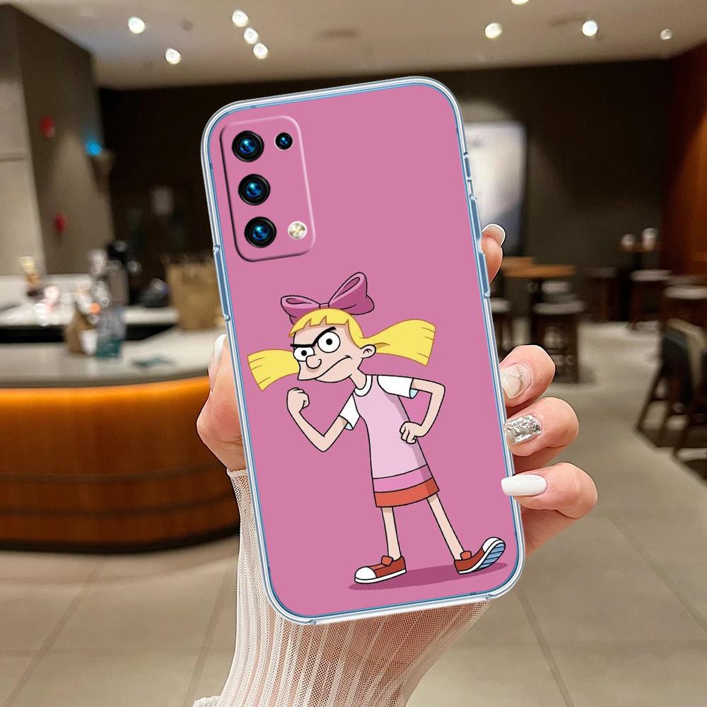 S-Special Art Hey A-Arnold Transparent Phone Case for Motorola Moto G7 G8 G9 G84 G85 G73 G24 G15 Z2 Play Power Plus