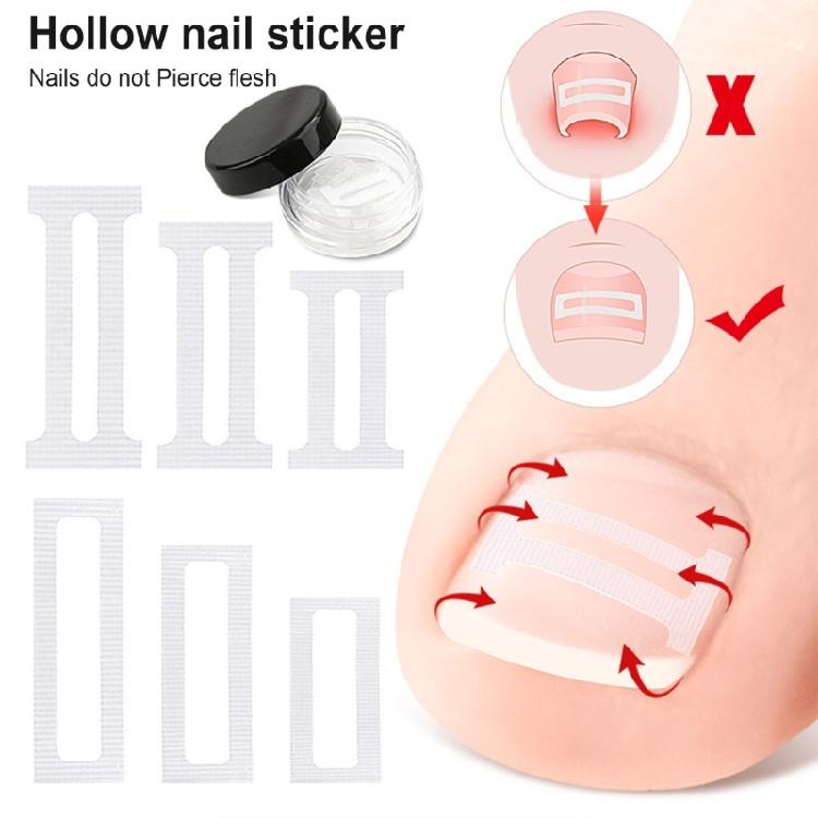10 Pezzi Strisce Correttive per Unghie Incarnite per Sollevamento Delicato e Allineamento dell'Unghia Strumenti per Pedicure da Salone o per Uso Domestico per Adulti