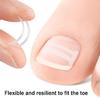 10 Pezzi Strisce Correttive per Unghie Incarnite per Sollevamento Delicato e Allineamento dell'Unghia Strumenti per Pedicure da Salone o per Uso Domestico per Adulti