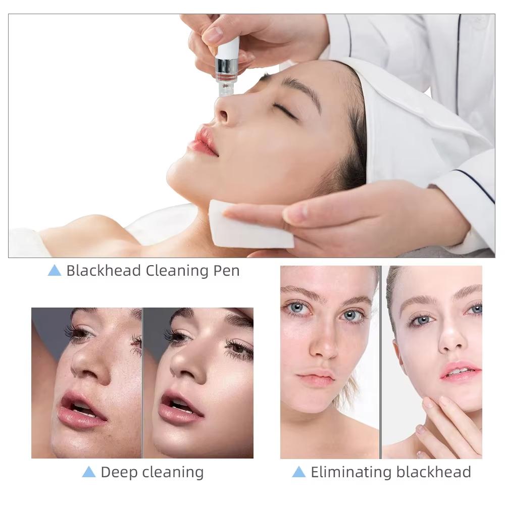 7-in-1 Multi-Functional Facial Beauty Device with RF Lifting, Oxygen Hydration, Ultrasonic Cleansing, and Skin Rejuvenation