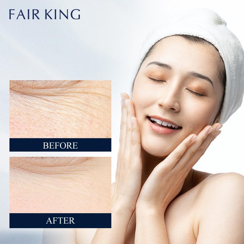 Retinol Eye Cream Dilutes Fine Lines Around The Eyes Relieves Eye Fatigue Eliminates Dark Circles and Eye Bags Eye Cream