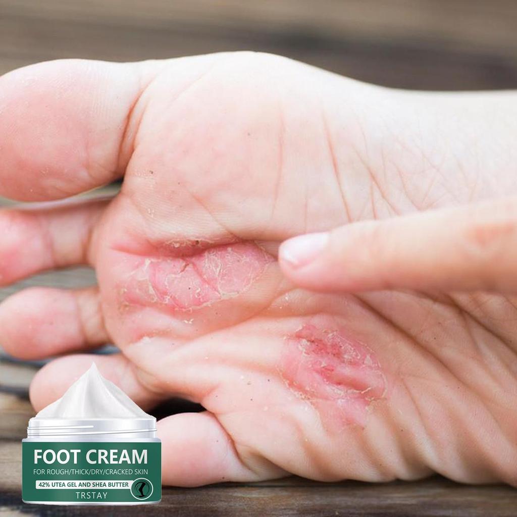 Creme para os pés, rachaduras no calcanhar para remover pele morta, máscara esfoliante seca para cuidados com a pele, pele suave e não irritante