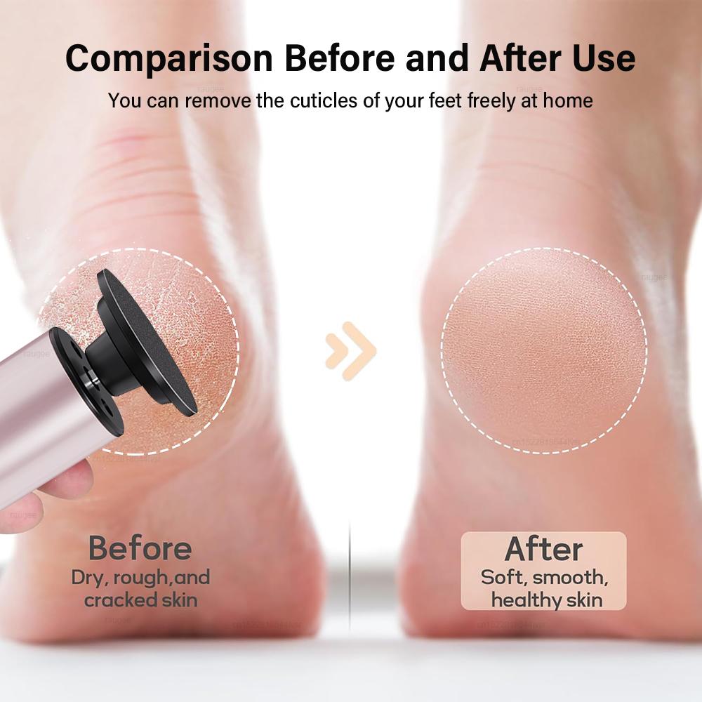 Electric Foot Grinder Callus Remover for Feet Foot Exfoliation Sander Electric Foot File Pedicure Machine Foot Dead Skin Remover