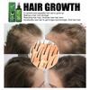 Hair Growth Spray Hydrating Moisturizing Hair Thickening Spray Professional Hair Regrowth Treatment Spray