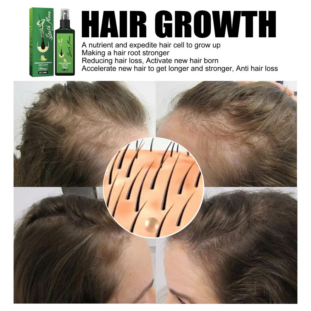 Hair Growth Spray Hydrating Moisturizing Hair Thickening Spray Professional Hair Regrowth Treatment Spray