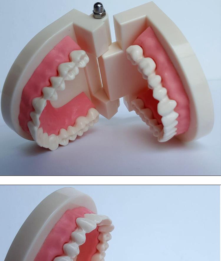Human Tooth Anatomy Model for Teaching and Simulation - Detachable Denture Mold