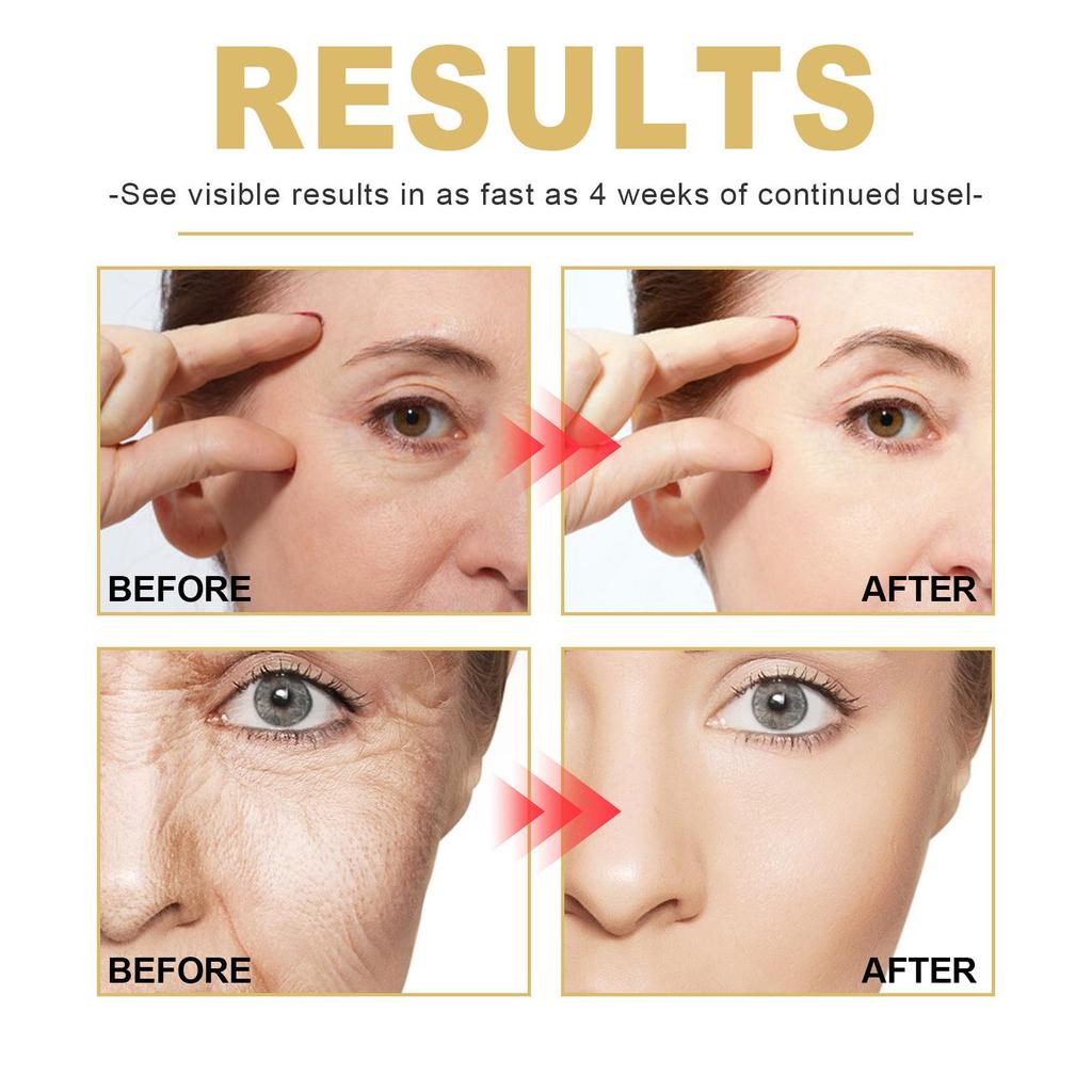 Golden Age Essence Reduces Fine Lines and Dark Circles and Moisturizes and Anti-wrinkle Skin