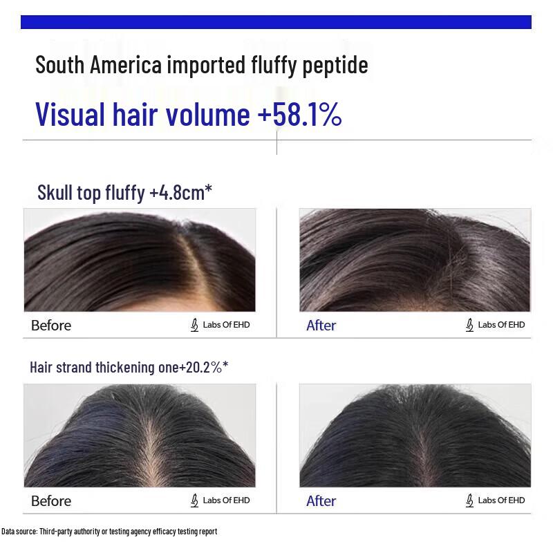 EHD Volumizing & Oil-Control Shampoo and Repair Hair Mask Set