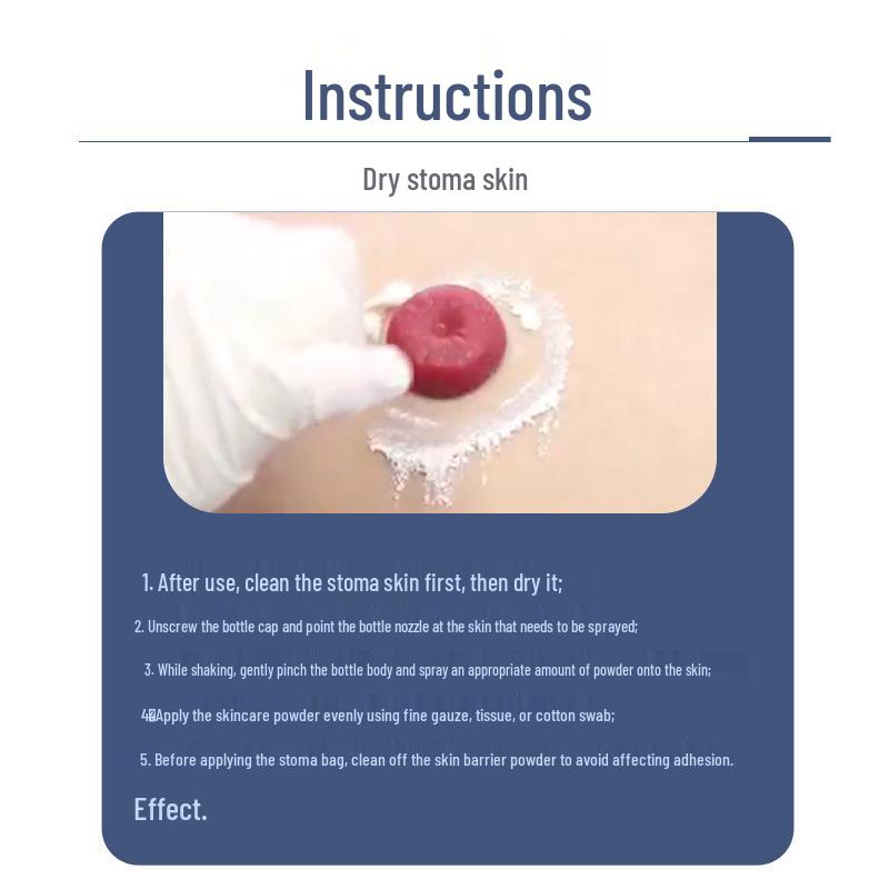 Pudră de uscare Stoma Skincare pentru copii și adulți: Îngrijirea pungii de stomie