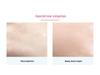 Red & Blue Light Cold/Hot Beauty Device with EMS Lifting and Thermal Conduction for Skincare