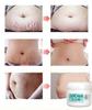 Natural Organic Postpartum Stretch Mark Removal Skin Repair Cream Body Pregnancy Scar  Cream For Women
