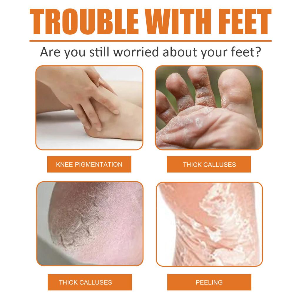 South Moon Foot Exfoliating Spray Moisturizing Dead Skin Removal Hydrating