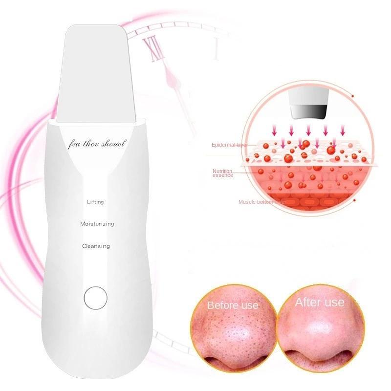 Deep Vibrate Ultrasonic Skin Scrubber Scrubber Deep Vibrate Facial Cleaner Shovel Face Scrubber Peeling Black Head Remover Facial Massager