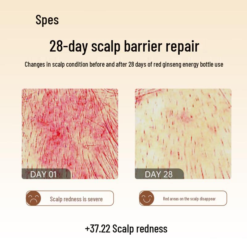 Spes Hyaluronic Acid Red Ginseng Oil Control Anti-Dandruff Shampoo