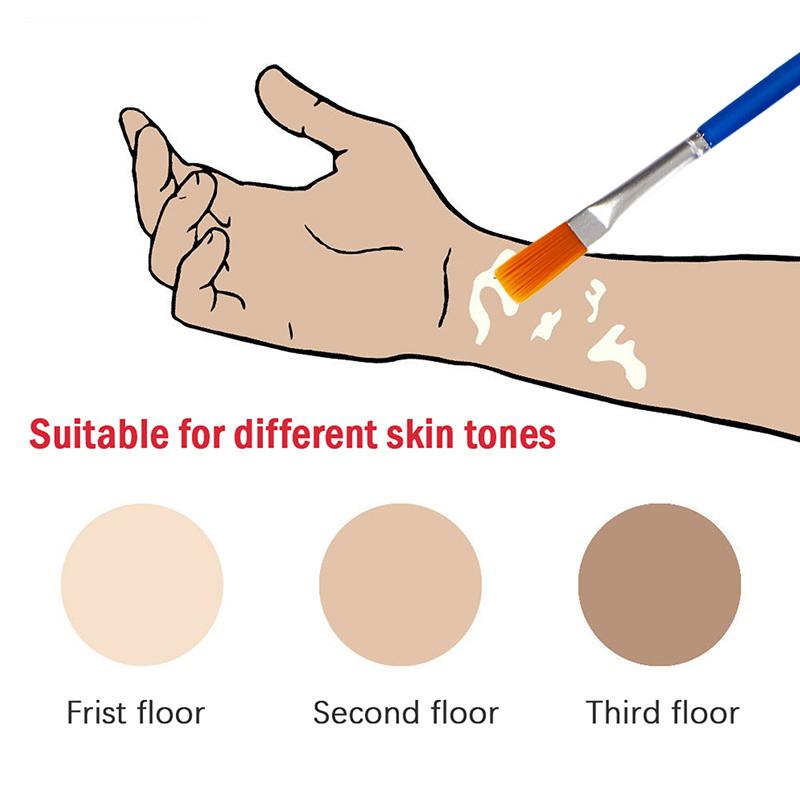 30 ml Vitiligo Leukoderma Abdeckflüssigkeit Wasserfeste Abdeckcreme Flüssigkeit Frauen Männer Gesicht Verfärbte Haut Vitiligo Patches Make-up