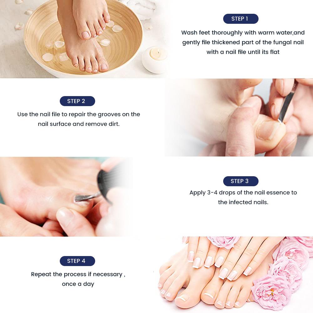 Gray Nail Paste, Thickened Shiny Nail, Gray Nail Repairs, Clean and Soft Nail Paste, Care for Hand, Foot and Toenail Decay