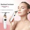 Rechargeable Electric Blackhead Remover & Bubble Facial Cleanser