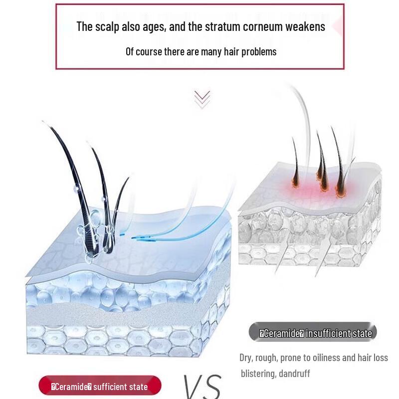 Slek Hydrating Smooth Anti-Dandruff Shampoo